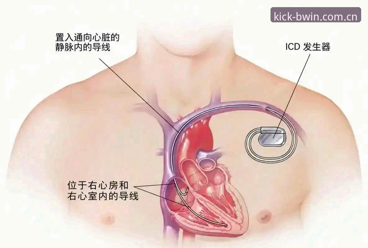 当埃里克森第五次倒下，除颤器还能撑起他的职业生涯吗？
